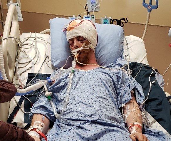 Bradley Eliason is in critical condition at KGH.