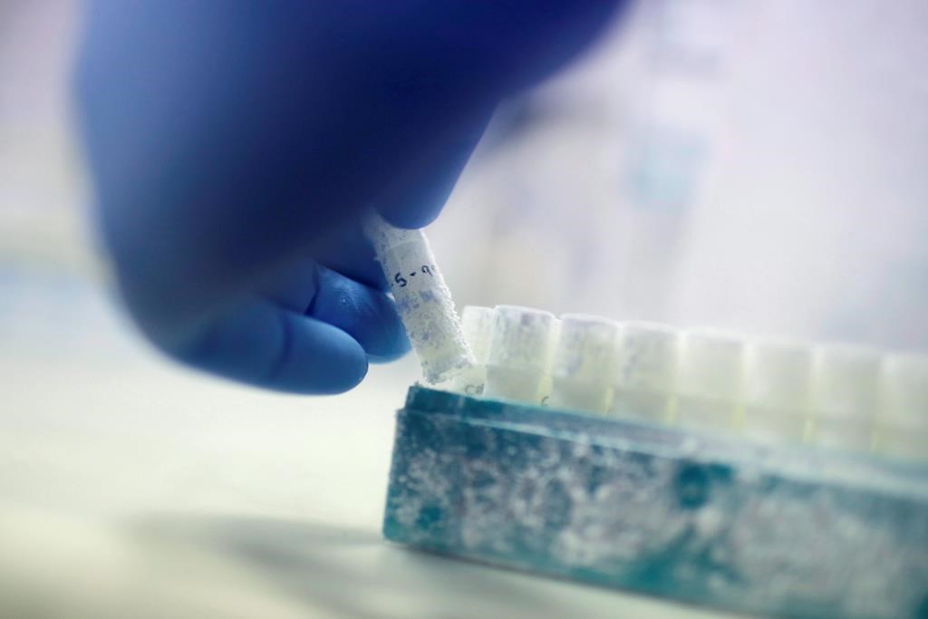 Scientist Fabrice De Bond picks up a vial containing frozen donor sperm samples in a lab at Melbourne IVF in Melbourne, Australia.