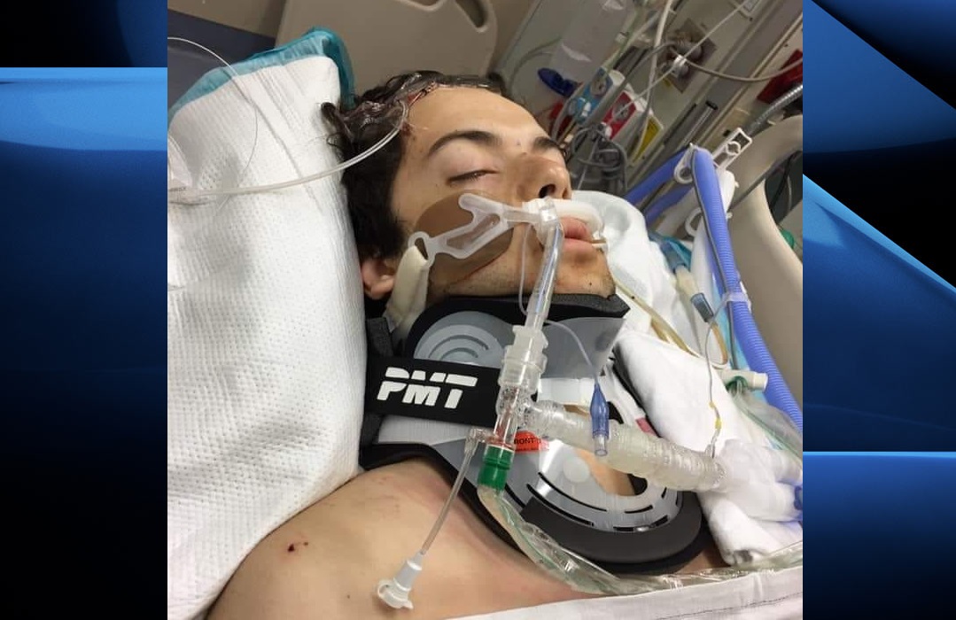 In a post to his Facebook page, Tino Casavecchia writes that instead of his celebrating his 18th birthday, his nephew now has to spend the day suffering from severe brain trauma.