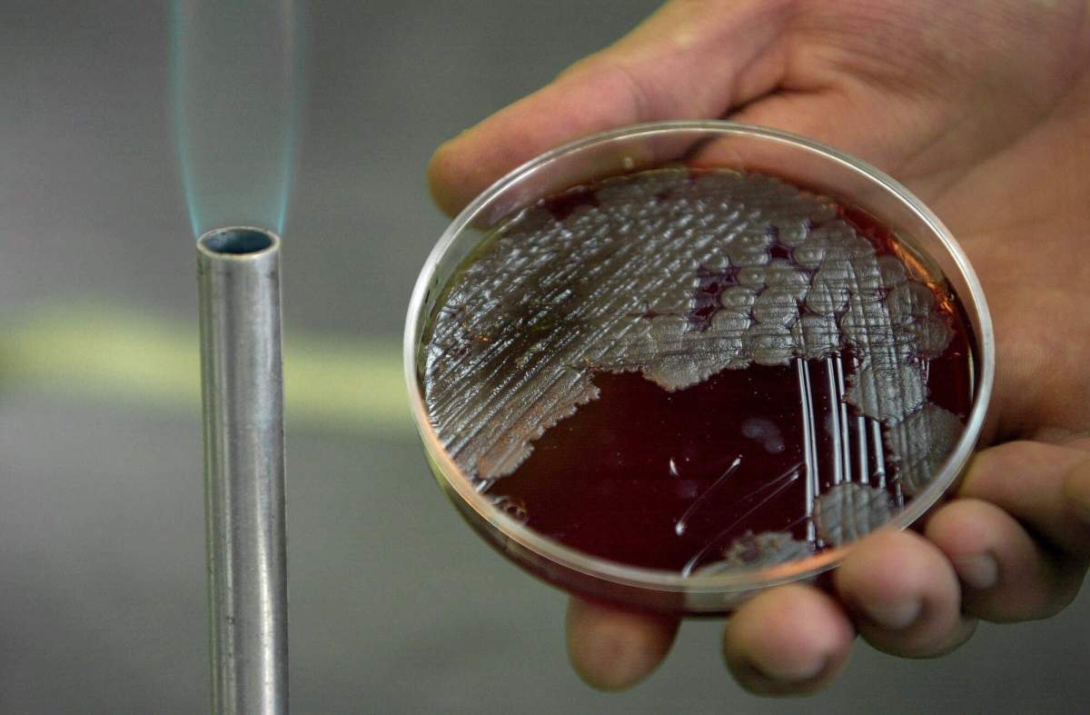 Anthrax bacteria is seen in a file photo from Oct. 17, 2001. 