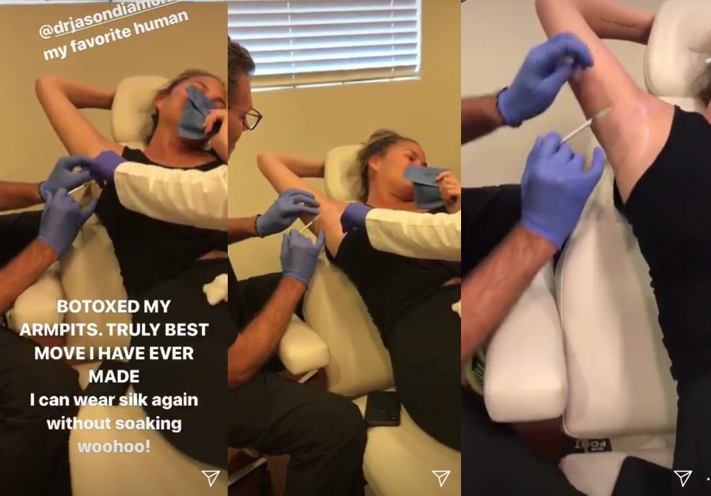 Chrissy Teigen/Instagram