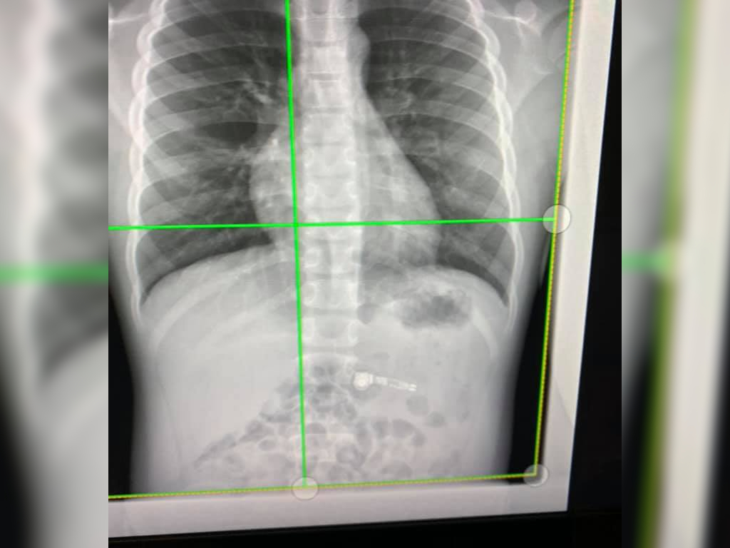 Kiara Stroud's son was rushed to the hospital after accidentally swallowing his AirPod.