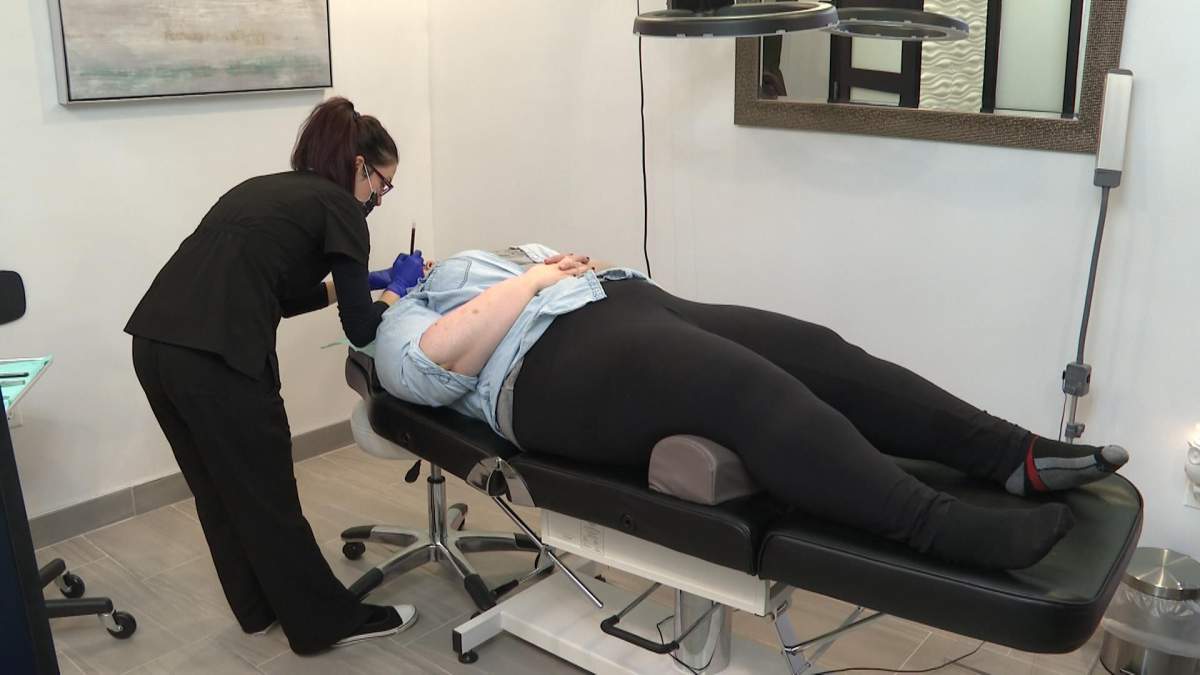 Microblading involves tattooing fine, hair-like strokes on the eyebrows.