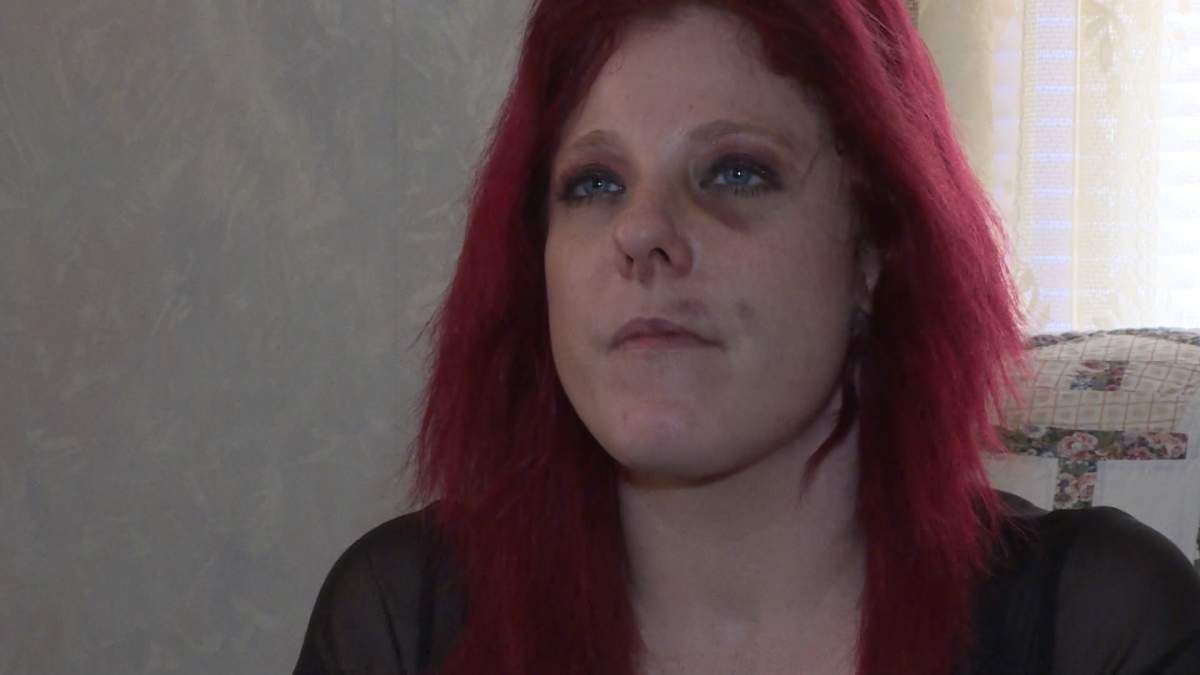 Melissa Ross has bruises under her eye and around her mouth following an arrest by Brockville police.