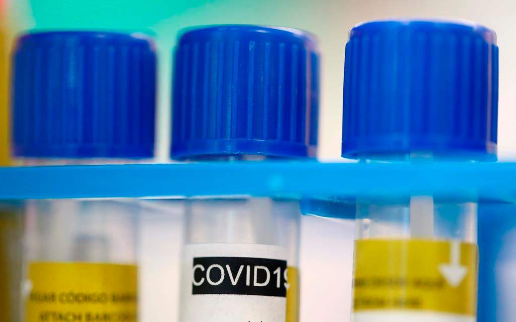 Tube tests stands in a holder as media visit the Microbiology Laboratory of the University Hospital, CHUV, during the coronavirus disease (COVID-19) outbreak in Lausanne, Switzerland, Monday, March 23, 2020. The Swiss authorities proclaimed on March 16, a state of emergency in an effort to halt the spread of the coronavirus and Covid-19 disease. The government declared that all entertainment and leisure businesses will shut down. Grocery stores, and hospitals will remain open and new border controls will be put in place. (Denis Balibouse/Keystone via AP, Pool).
