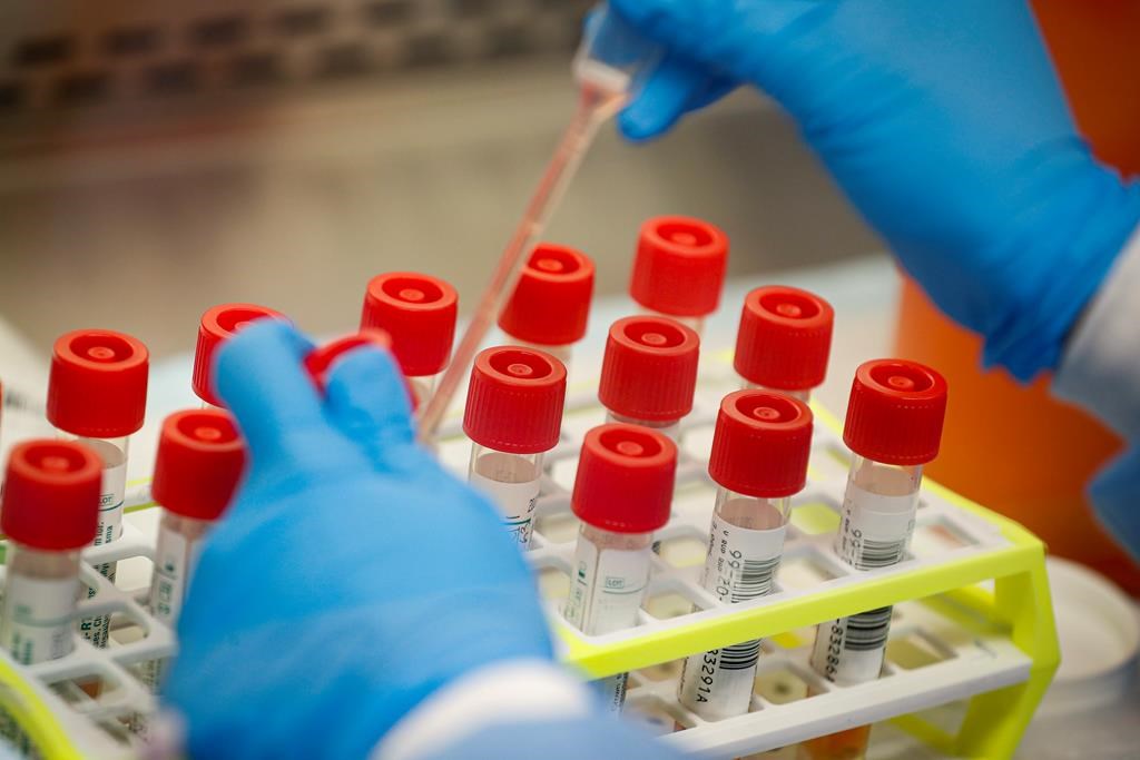 In this March 11, 2020, file photo, a technician prepares COVID-19 patient samples for testing at a laboratory in New York's Long Island.