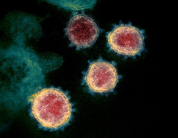 This undated electron microscope image made available by the U.S. National Institutes of Health in February 2020 shows the virus that causes COVID-19. 