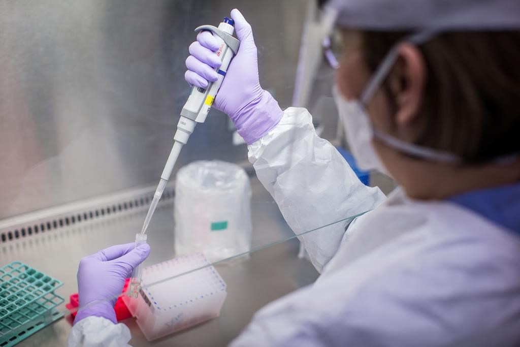 Katie Kempton, a laboratory technologist at LifeLabs, demonstrates one of the steps taken when a specimen is tested for the novel coronavirus at the company's lab, in Surrey, B.C., on March 26, 2020.