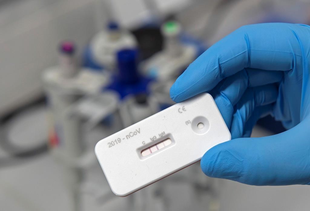 A scientist presents an antibody test for coronavirus in a laboratory of the Leibniz Institute of Photonic Technology (Leibniz IPHT) at the InfectoGnostics research campus in Jena, Germany, Friday, April 3, 2020.