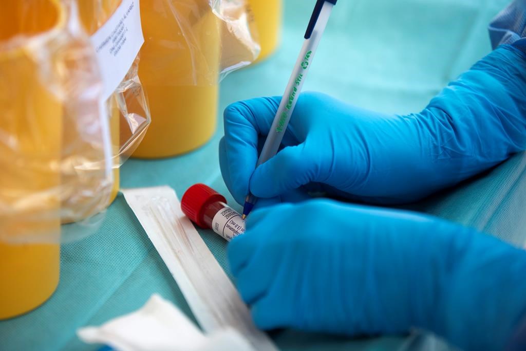A health worker takes a sample for a PCR test for the COVID-19 coronavirus at a hospital in Coslada, Spain, Monday, April 20, 2020.