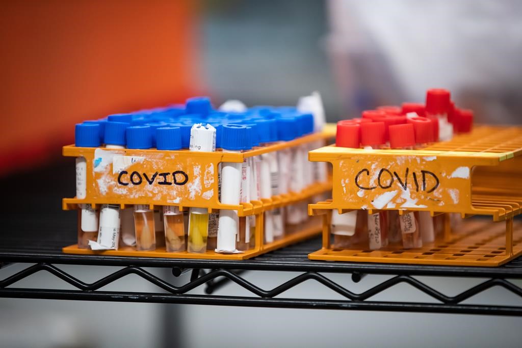 Peterborough Public Health reports a second death related to COVID-19 complications.
