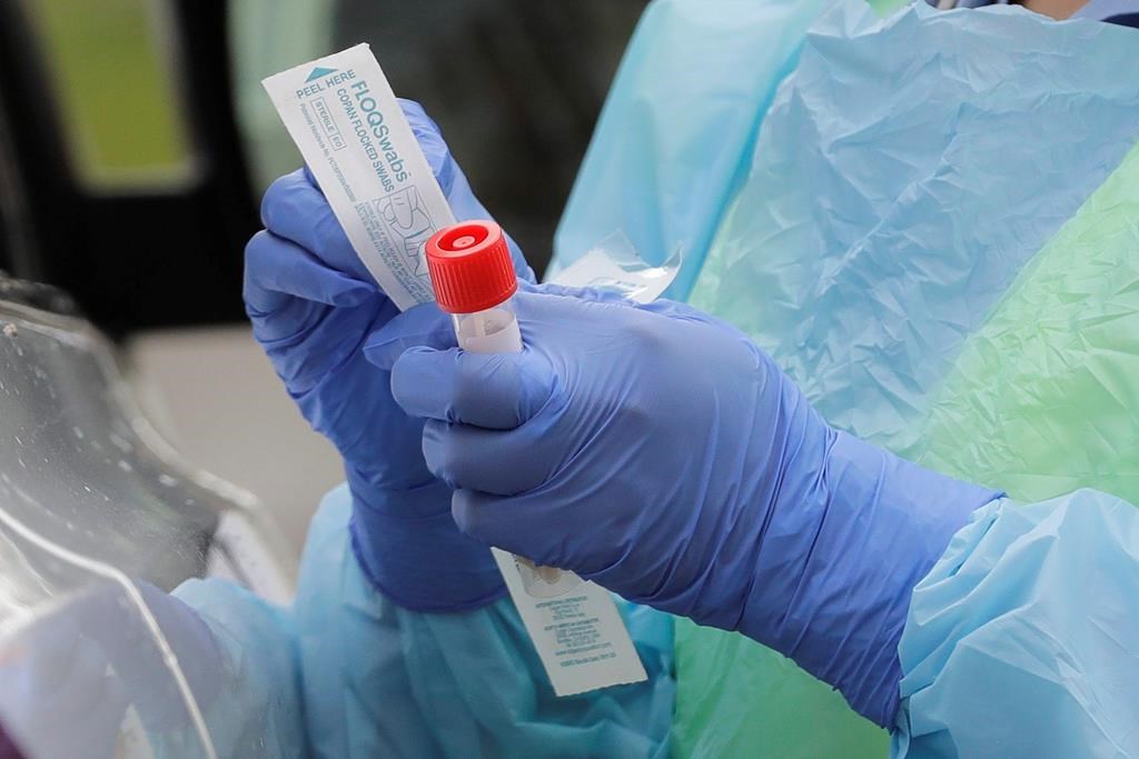 Health officials say there are 101 active coronavirus cases in Saskatchewan.