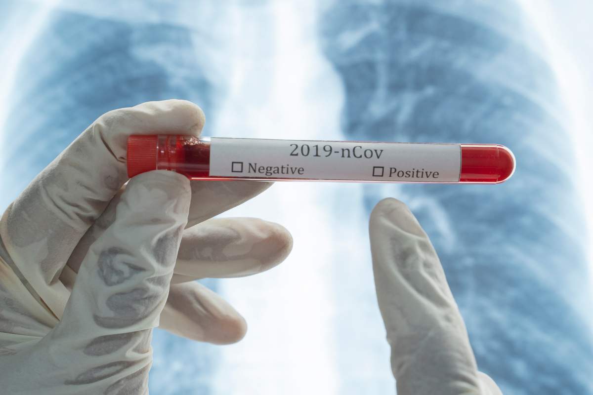 The SHA says an individual who tested positive for the coronavirus may have likely been infectious at the time they visited the Swift Current businesses.