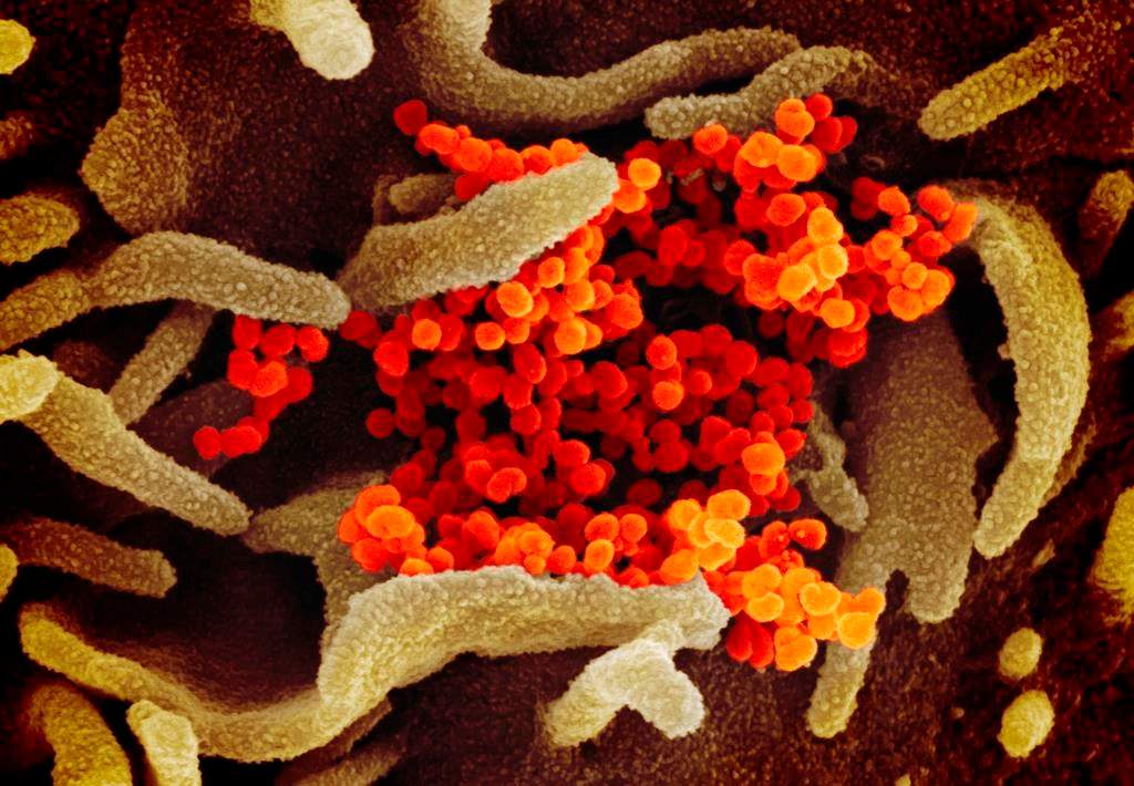 This undated electron microscope image made available by the U.S. National Institutes of Health in February 2020 shows the Novel Coronavirus SARS-CoV-2, orange, emerging from the surface of cells, green, cultured in the lab. Also known as 2019-nCoV, the virus causes COVID-19. The sample was isolated from a patient in the U.S.