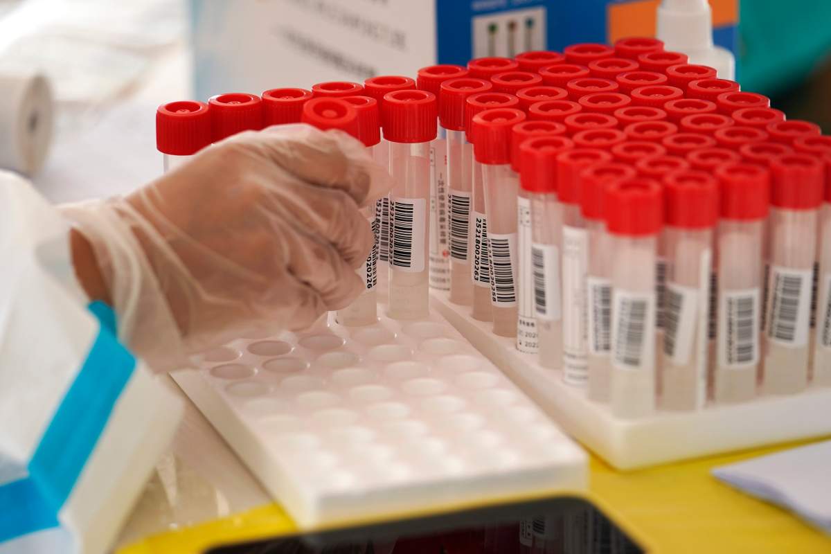 Saskatchewan health authorities say there are 13 new coronavirus cases in the province, with 128 active cases and 793 total recoveries.