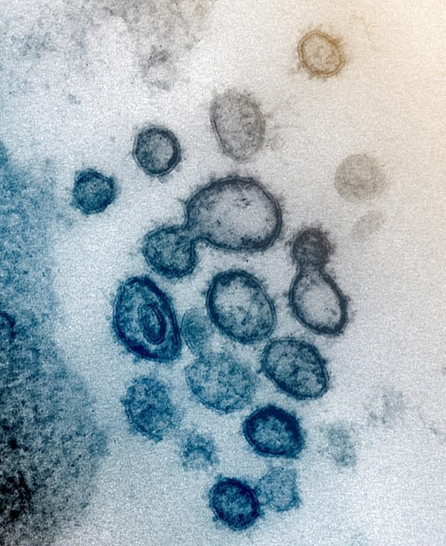 A new research study from Western University and Lawson Health has linked stroke as a side effect of the novel coronavirus.