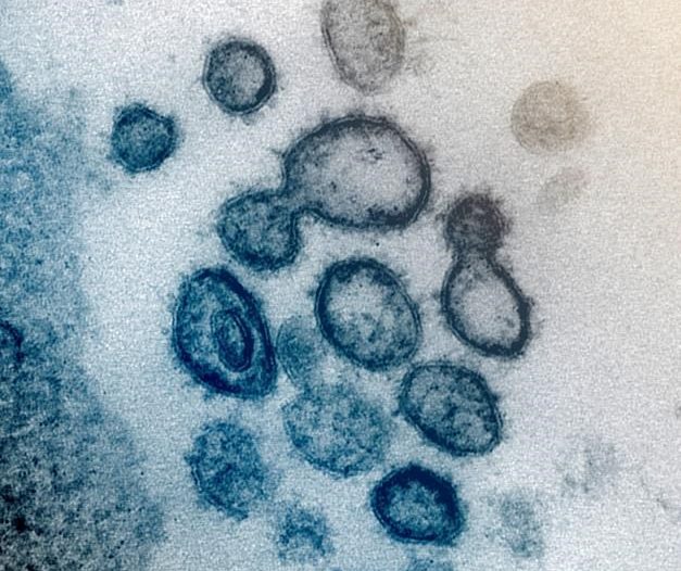 This undated electron microscope image made available by the U.S. National Institutes of Health in February 2020 shows the Novel Coronavirus SARS-CoV-2.