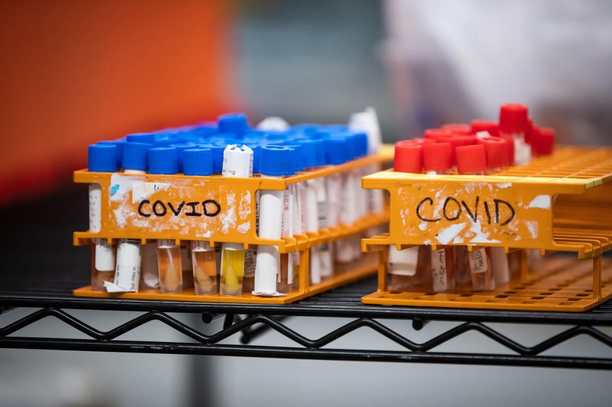 Specimens to be tested for COVID-19 are seen at LifeLabs after being logged upon receipt at the company's lab, in Surrey, B.C., on Thursday, March 26, 2020. The doctor overseeing Canada's COVID-19 antibody research says we should get the first glimpse of how many Canadians may already have had COVID-19 by the middle of this month. THE CANADIAN PRESS/Darryl Dyck.