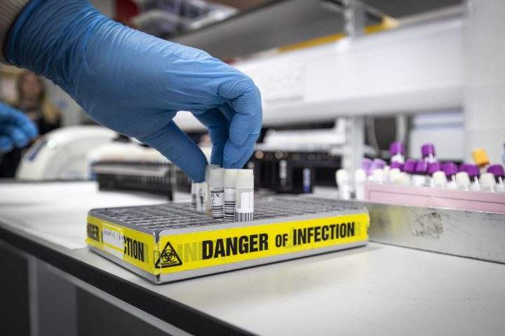 The Durham Region Health Department confirmed Tuesday that the couple who tested positive for the U.K. variant of the coronavirus is under investigation.