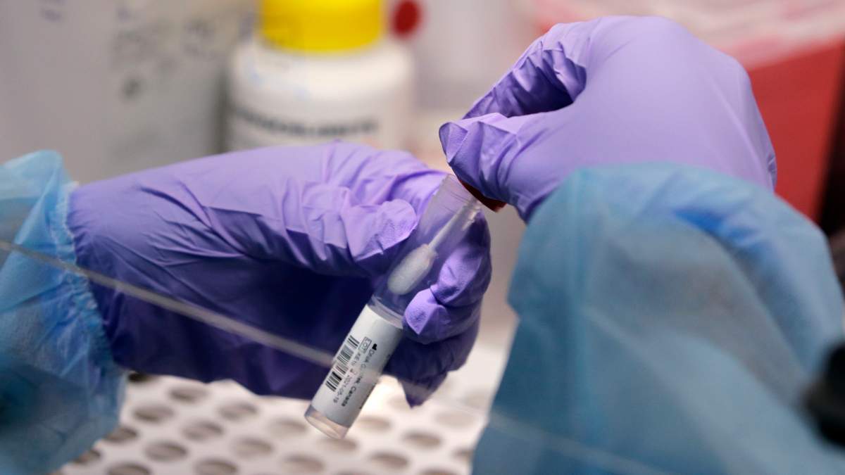 FILE - A biomedical engineering graduate student, holds a swab and specimen vial, Thursday, July 23, 2020, at Boston University in Boston.