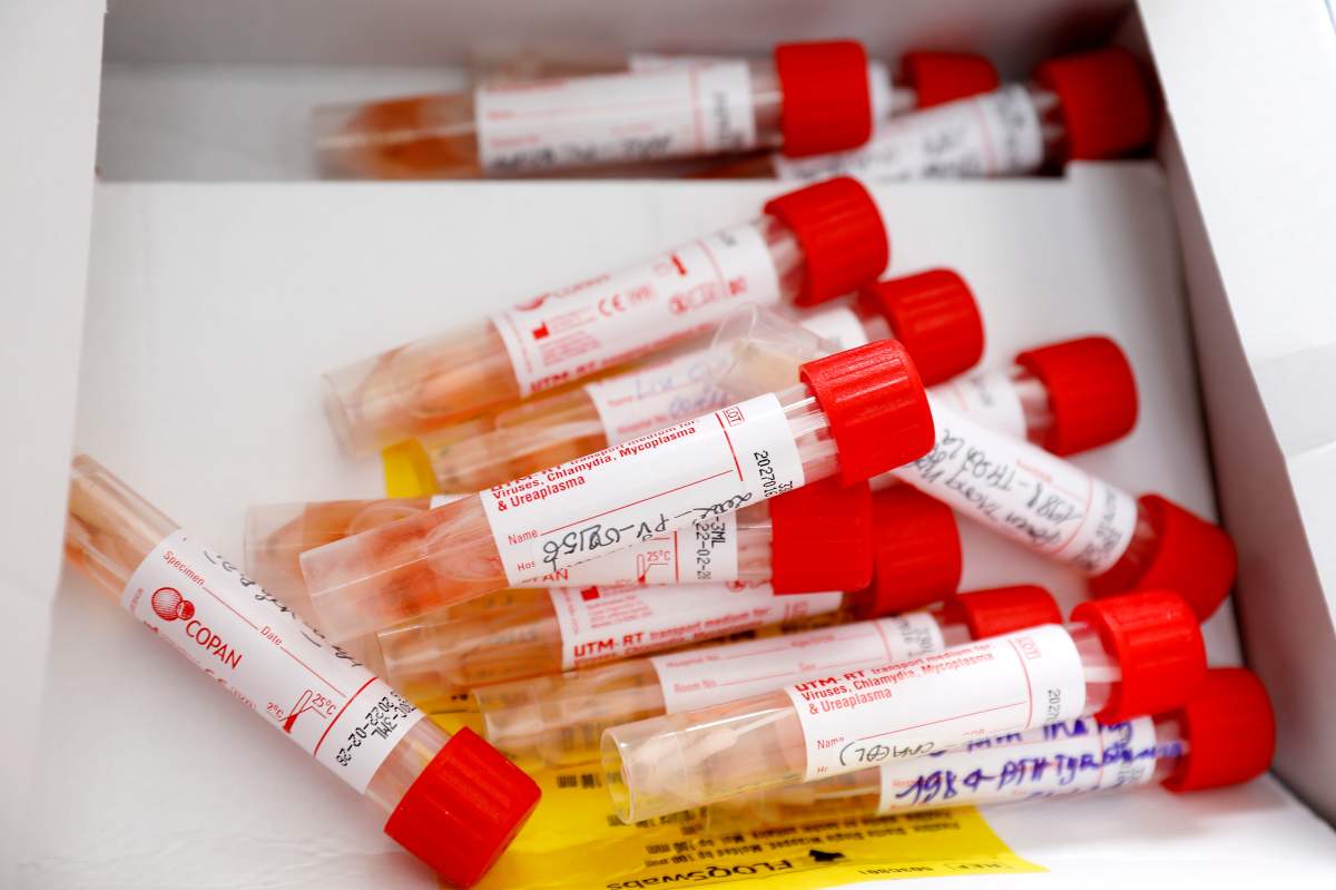 Swab samples are stored at a COVID-19 testing facility in this file photo.
