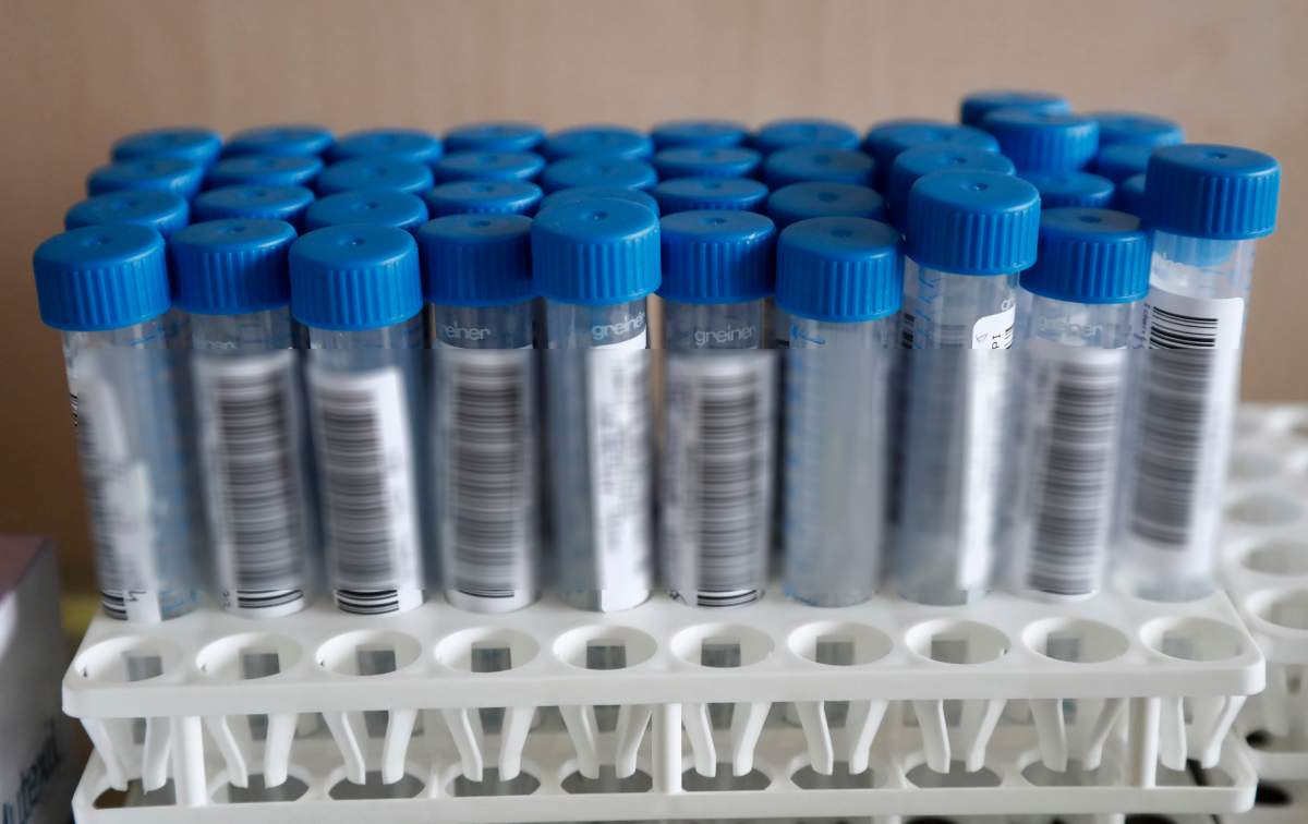 View of nasal swab samples at a test station for COVID-19 in Montpellier, France, 09 February 2021. The top French medical authority (Haute autorite de Sante) has approved the vaccine AstraZeneca-Oxford for use in France, but only for people under 65, echoing decisions made in Sweden, Germany, Belgium and Switzerland over concerns about a lack of data on the effectiveness of the vaccine for over 65s.