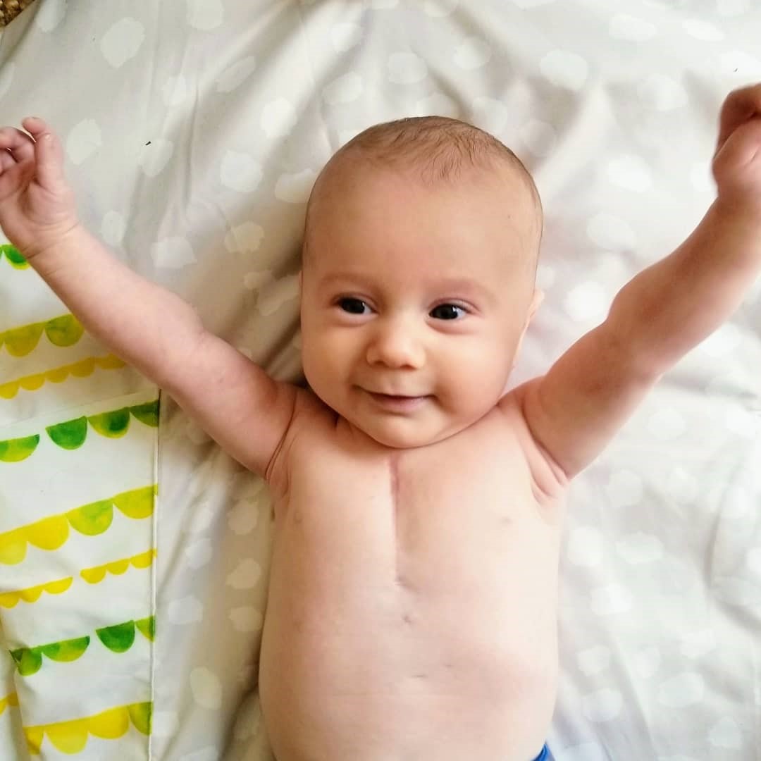 Roman, happy and healthy at home following open-heart surgery to correct a congenital heart defect (Justina Spencer/Provided)