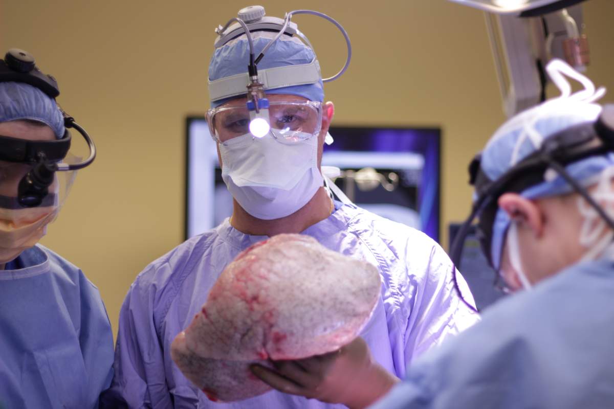 Dr. Marcelo Cypel holding a pair of lungs.
