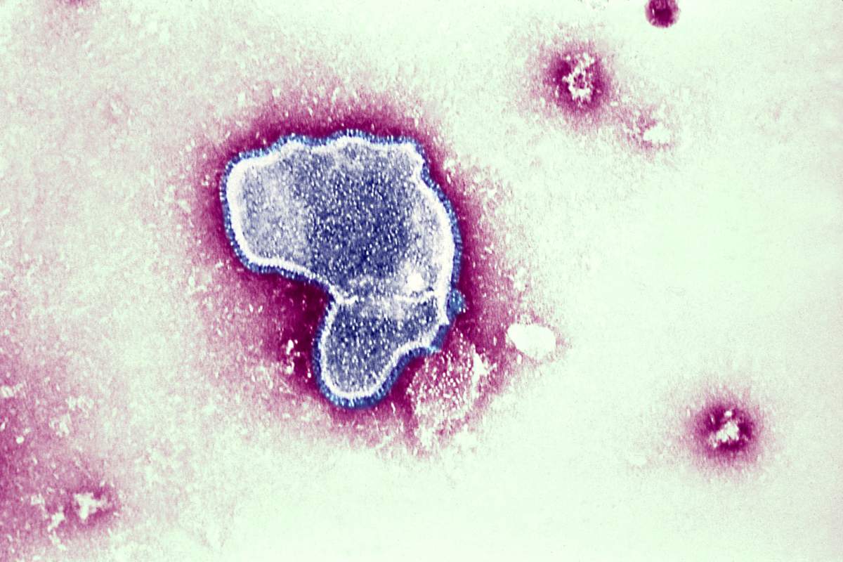 Respiratory Syncytial Virus