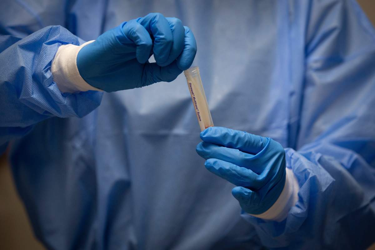 Saskatchewan health officials report 105 new confirmed cases of COVID-19, bringing the total to 82,442 reported cases.
