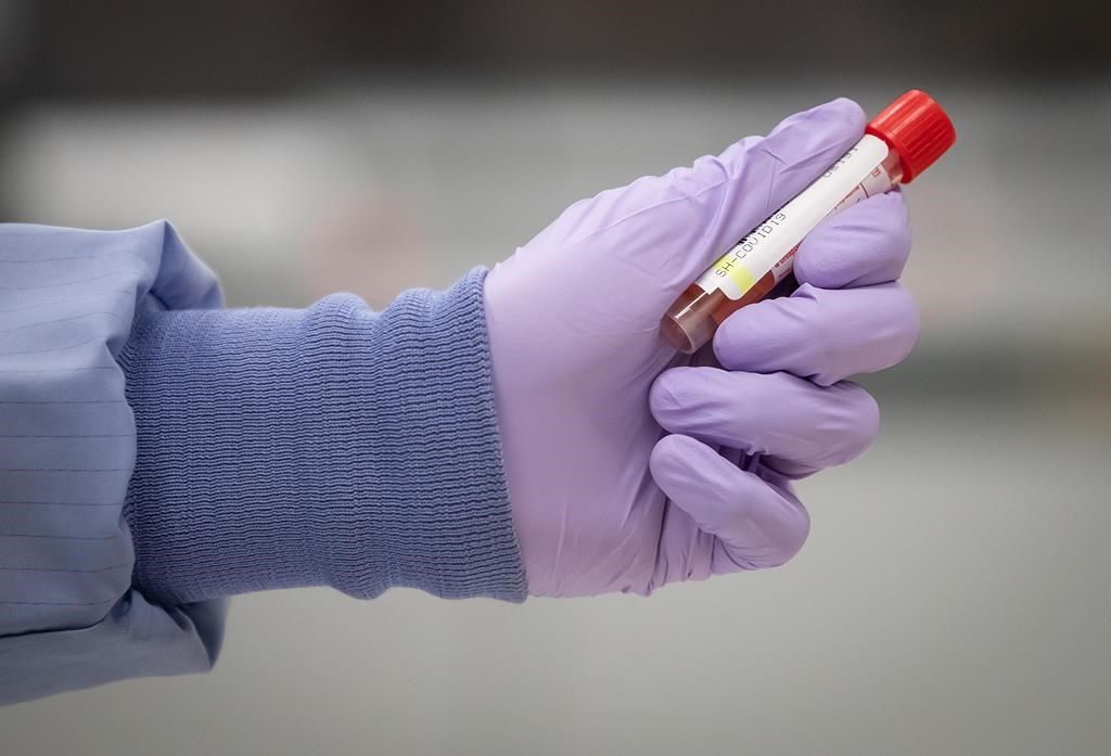 A laboratory technical assistant handles a specimen.