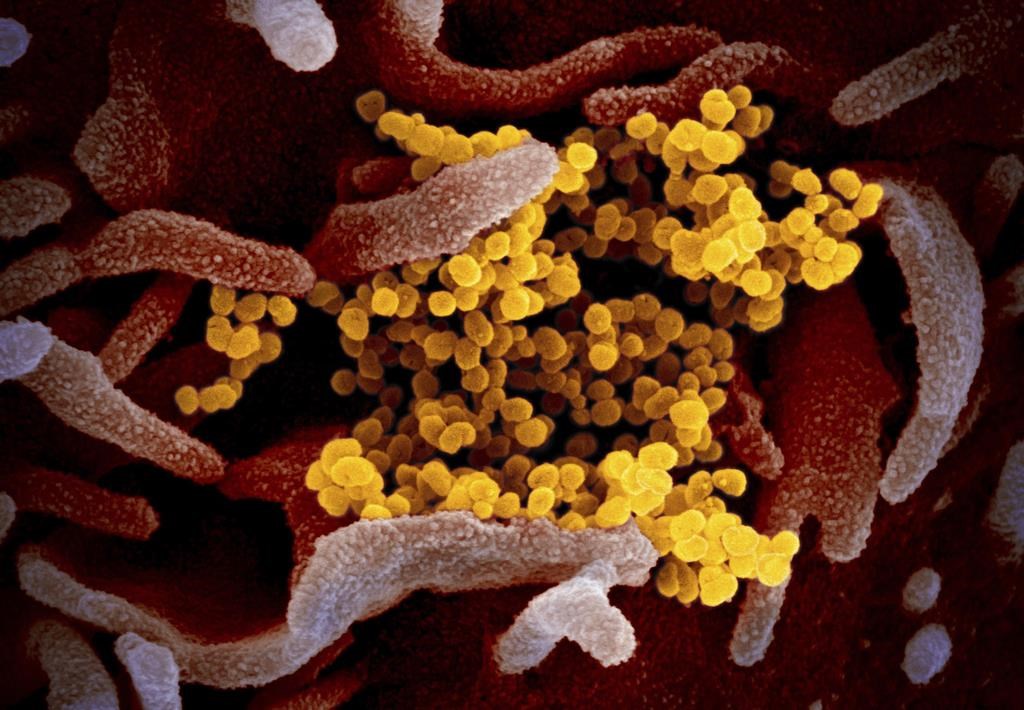 covid coronavirus electron image file