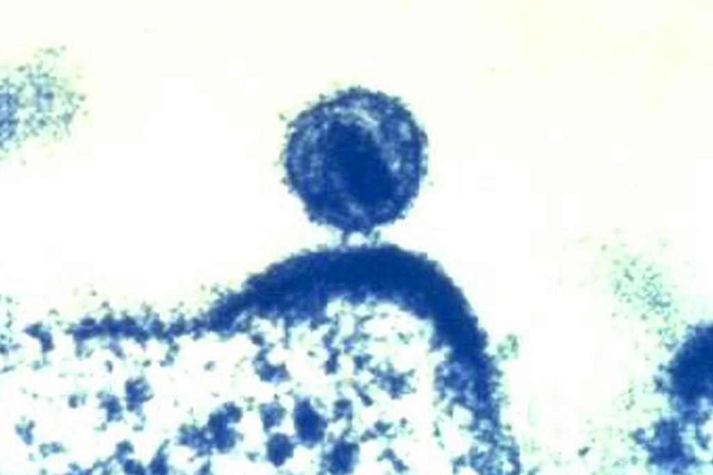 HIV
