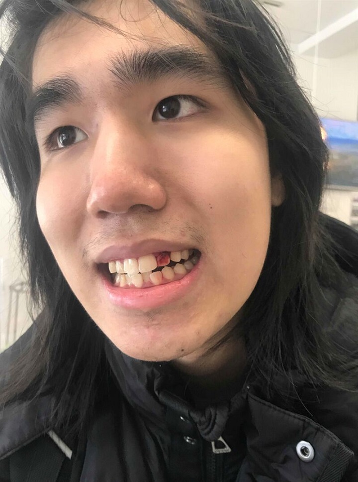 Dallas Ly, 20.