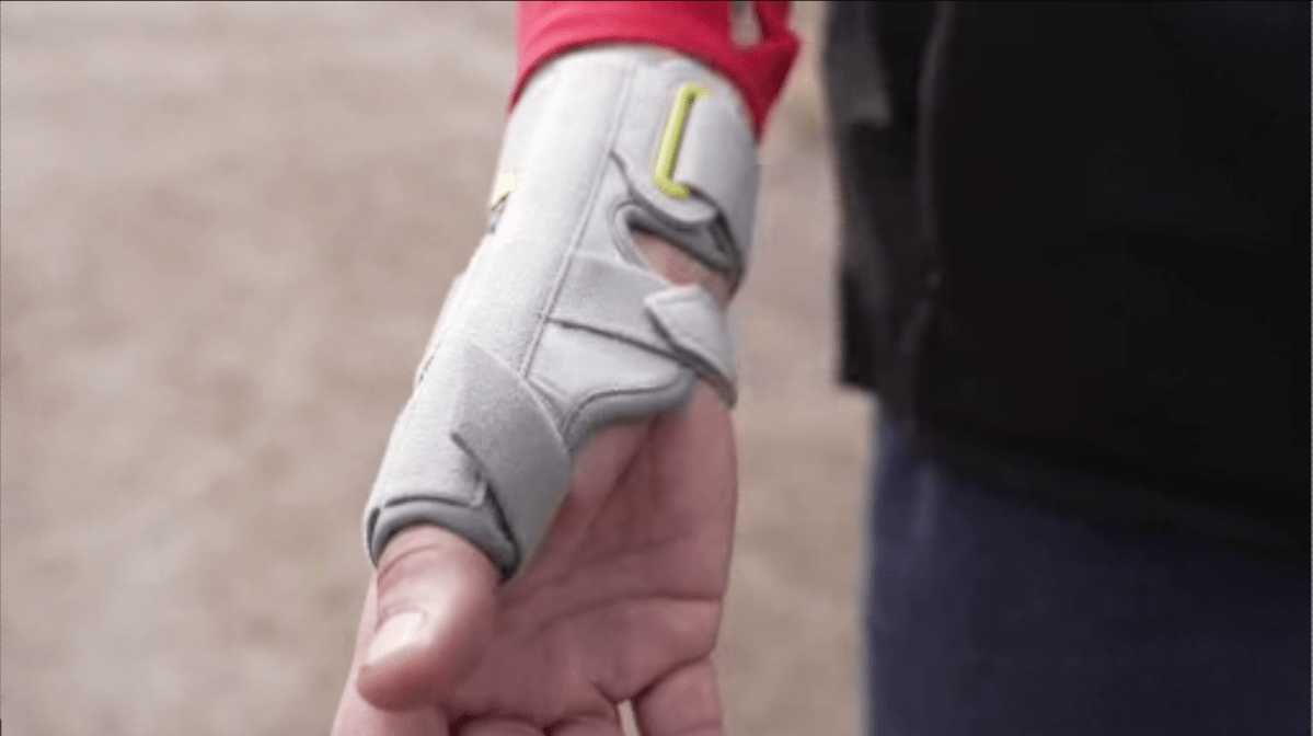 Edgardo Pacheco, 53, claims he suffered a wrist injury following a physical interaction with a Hamilton police officer out front of his residence on the Mounatin in the evening of March 8.