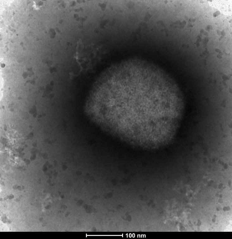 In this photo provided by the Unidad de Microscopa Electronica del ISCIII in Madrid, on Thursday May 26, 2022, an electronic microscope image shows the monkeypox virus seen by a team from the Arbovirus Laboratory and the Genomics and Bioinformatics Units of the Carlos III Health Institute (ISCIII) in Madrid. 