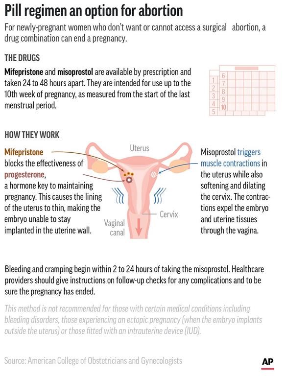 Medication abortion
