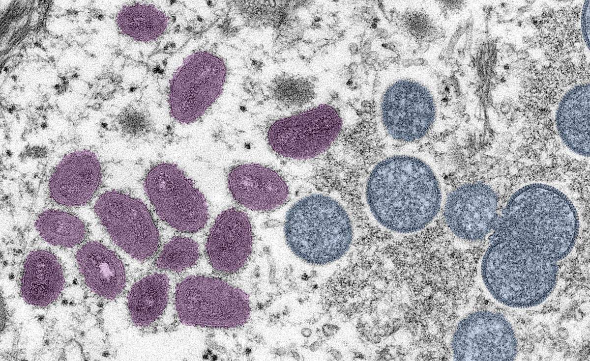 Monkeypox Virus