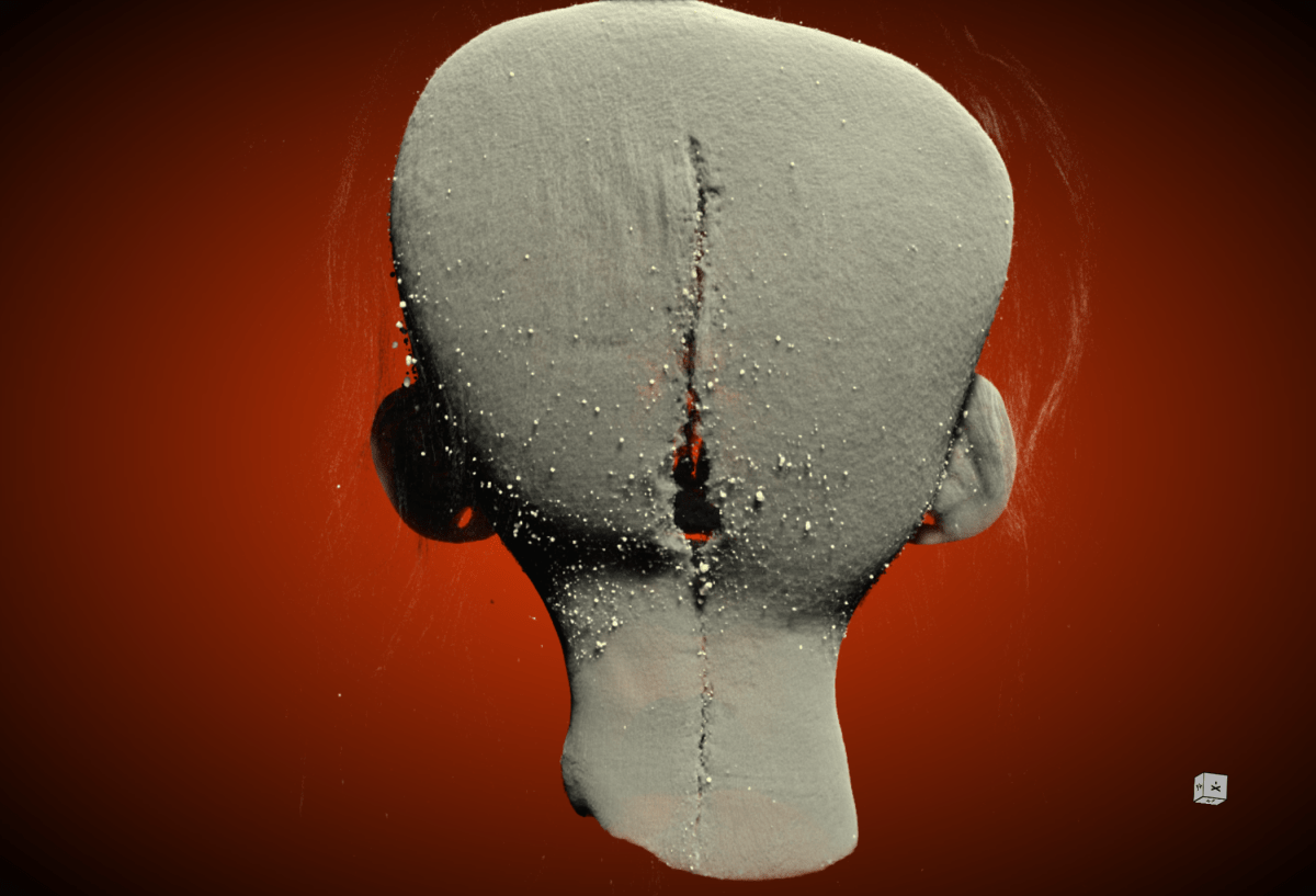 Original caption: “Digital visualization of the posterior incision and stitching. (Micro-CT image of the incision at the rear of the skull, windowed and leveled to remove the hair.)”