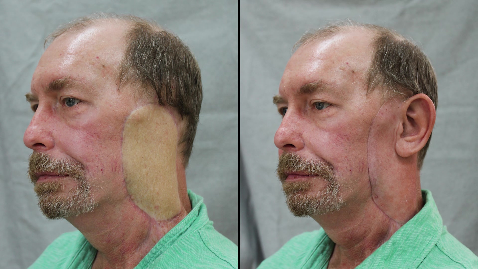 Steve Butler before and after.