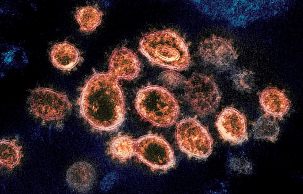 An outbreak of COVID-19 has been declared at the South Muskoka Memorial Hospital site in Bracebridge, Ont. The outbreak currently includes eight patients and six staff across four inpatient units.. File photo - THE CANADIAN PRESS/AP-NIAID-RML via AP.
