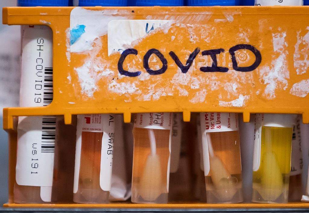Specimens to be tested for COVID-19 are seen in Surrey, B.C., on Thursday, March 26, 2020. 