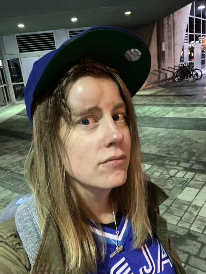 Topps says in a post on X, previously known as Twitter, that it produced 110 copies of the card that show McGuire with an enormous bump on her forehead above her right eye.
