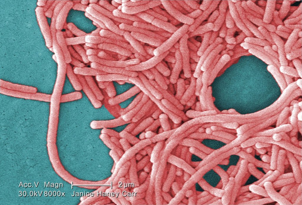 This 2009 colorized 8000X electron micrograph image provided by the U.S. Centers for Disease Control and Prevention shows a large grouping of gram-negative Legionella pneumophila bacteria. THE CANADIAN PRESS/AP-Janice Haney Carr.