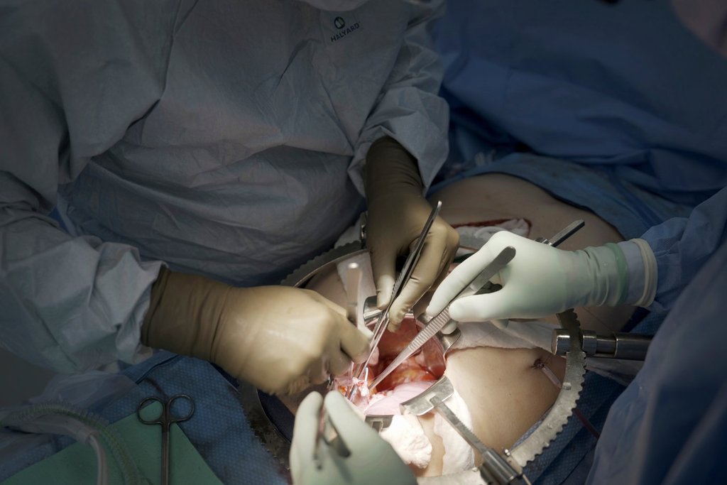 FILE - Surgeons at NYU Langone Health prepare to transplant a pig's kidney into a brain-dead man in New York on July 14, 2023. (AP Photo/Shelby Lum, File).