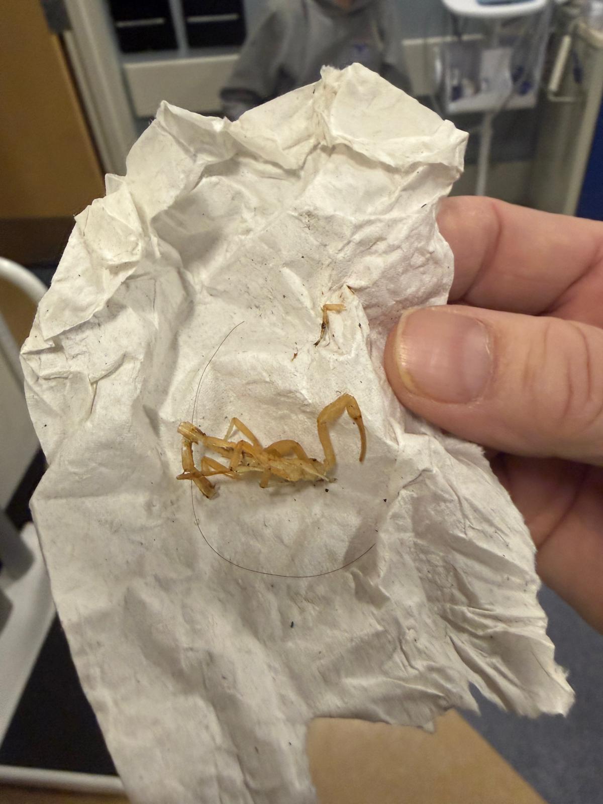 The dead scorpion after biting Luke Susi.