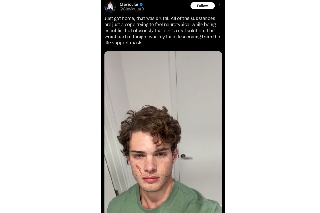 A screenshot of Clavicular's post on X.,